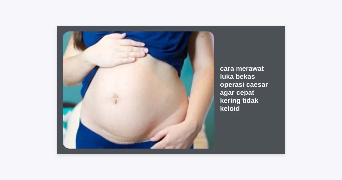 Bekas Caesar Rapi Cara Merawat Luka Bekas Operasi Caesar Agar Cepat Kering Tidak Keloid ...